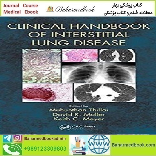 Clinical Handbook of Interstitial Lung Disease TRUE PDF price 1€