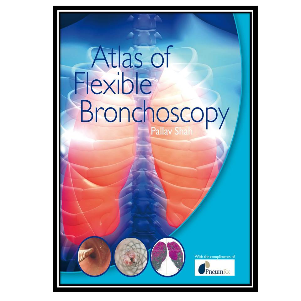 کتاب Atlas of flexible bronchoscopy اثر Pallav Shah انتشارات مؤلفین طلایی