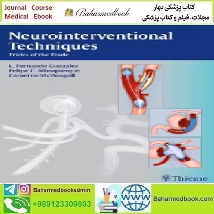 Neurointerventional Techniques Tricks o