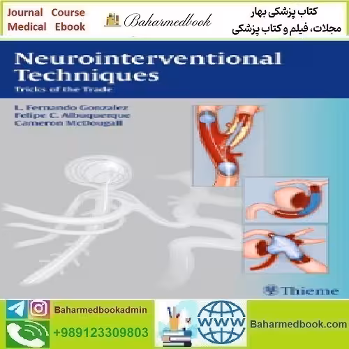 Neurointerventional Techniques Tricks o