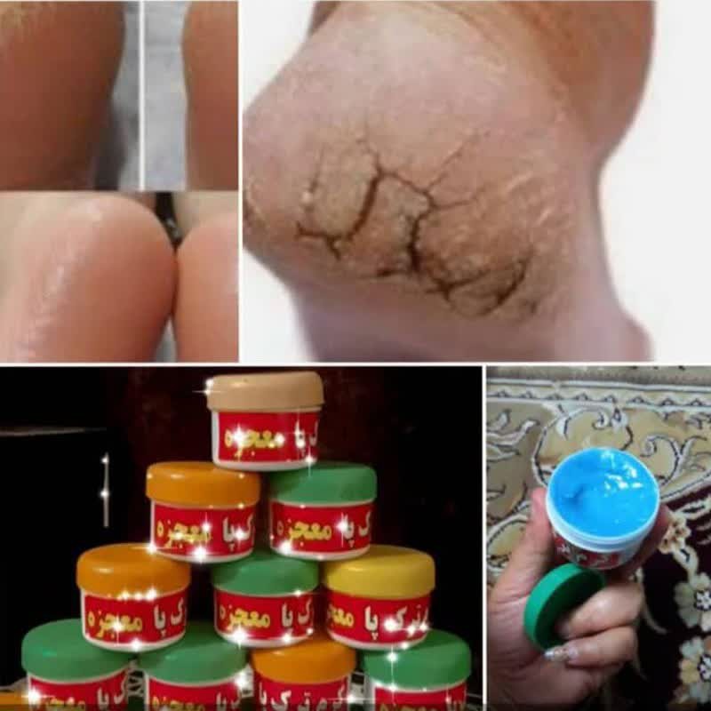 کرم ترک پا