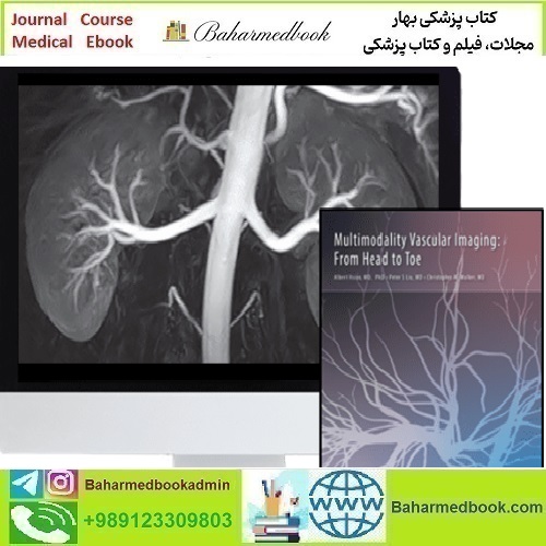 Multimodality Vascular Imaging From Head to Toe 2020 video c