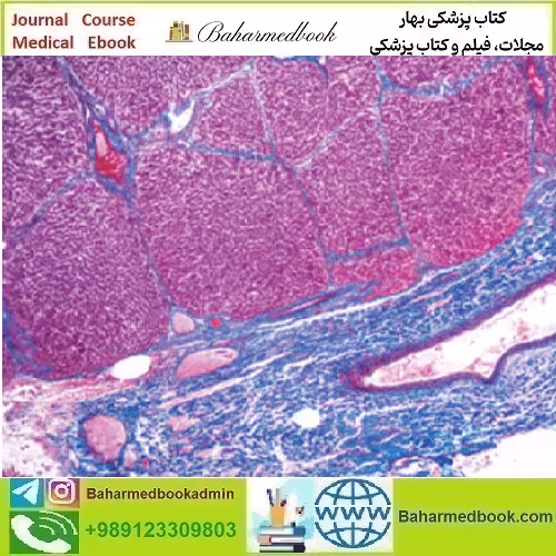 Current Topics in Gastrointestinal and Liver Pathology 2023 vide