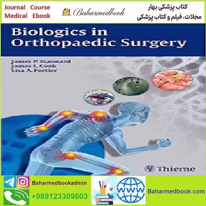 Biologics in Orthopaedic Surgery TRUE PDF price 1€ - کتاب پزشکی بهار