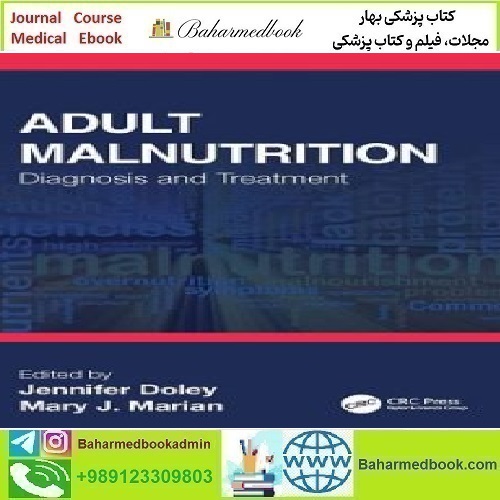 Adult Malnutrition Diagnosis and Treatment 2023 TRUE P