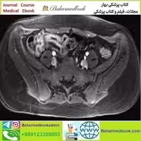 ARRS A Guide to Bowel Imaging 2019 video course price 30€ - کتاب پزشکی بهار