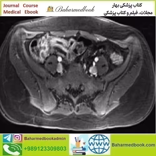ARRS A Guide to Bowel Imaging 2019 video course price 30€ - کتاب پزشکی بهار