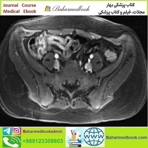 ARRS A Guide to Bowel Imaging 2019 video course price 30€ - کتاب پزشکی بهار