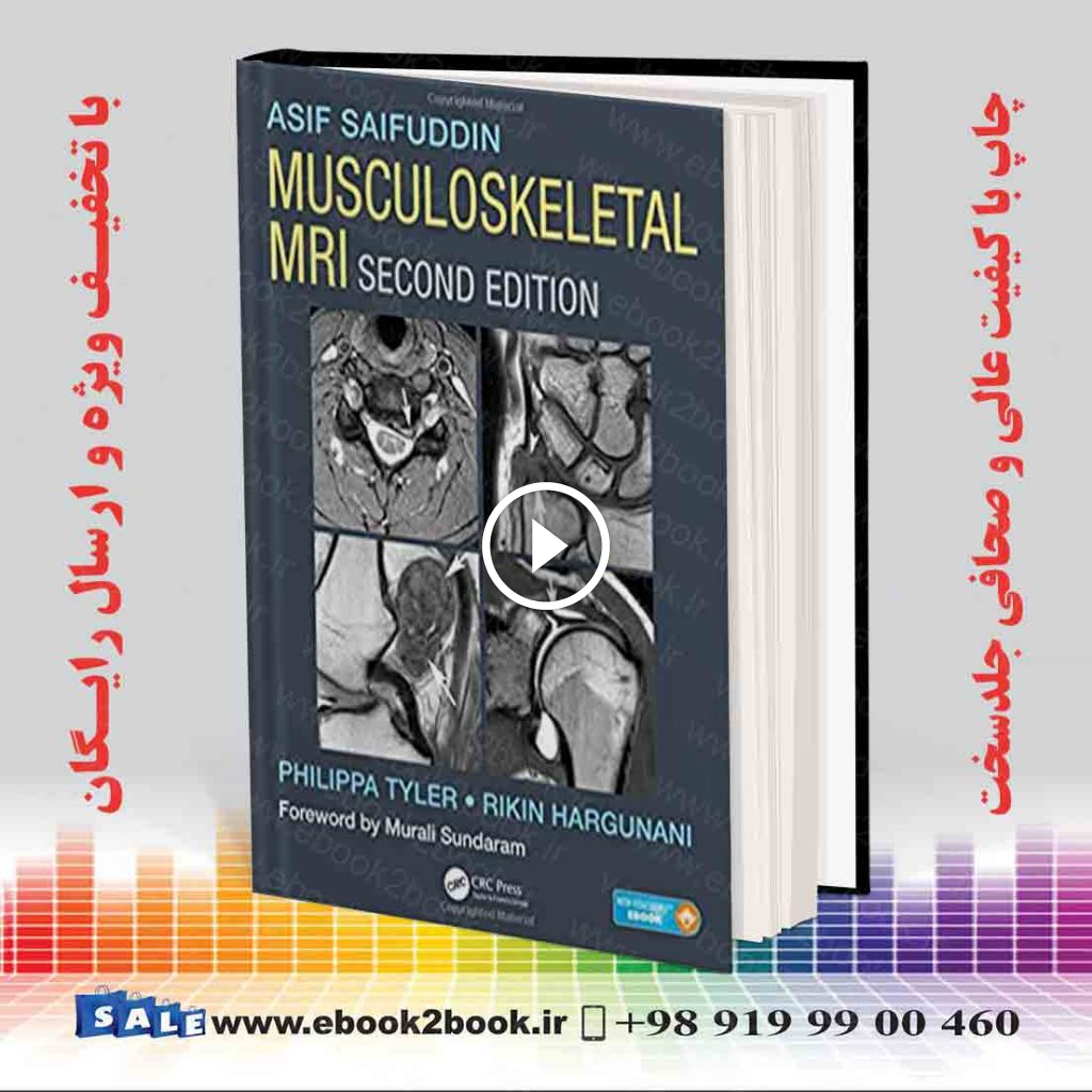 Musculoskeletal MRI 2nd Edition