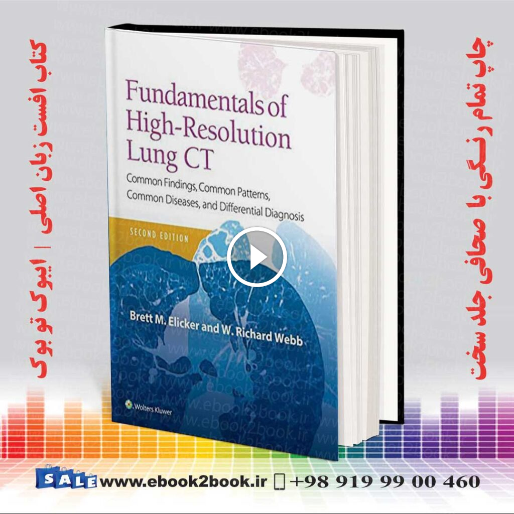 Fundamentals of High-Resolution Lung CT 2nd Edition