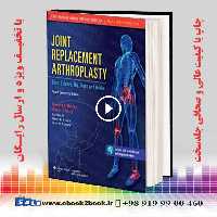 Joint Replacement Arthroplasty (Volume 2) Fourth