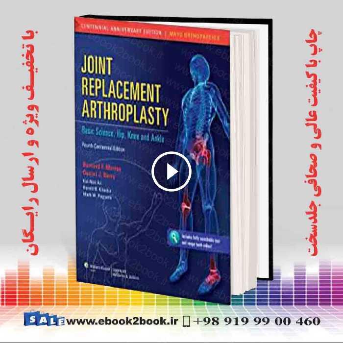 Joint Replacement Arthroplasty (Volume 2) Fourth
