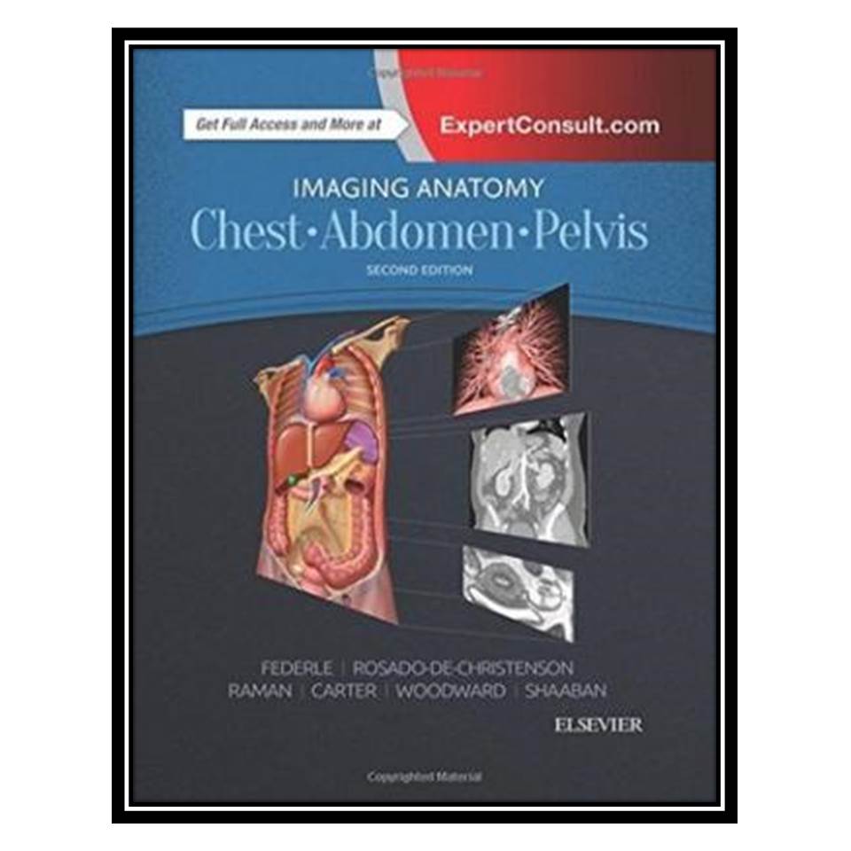 کتاب Imaging Anatomy Chest,Abdomen,Pelvis اثر Michael P Federle et al انتشارات مؤلفین طلایی