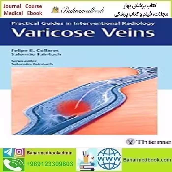 Varicose Veins Practical Guides in Interventional Radiology 2017