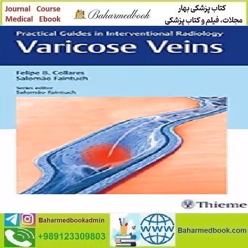 Varicose Veins Practical Guides in Interventional Radiology 2017
