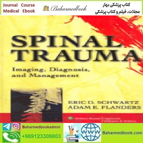 Spinal Trauma Imaging Diagnosis and Management