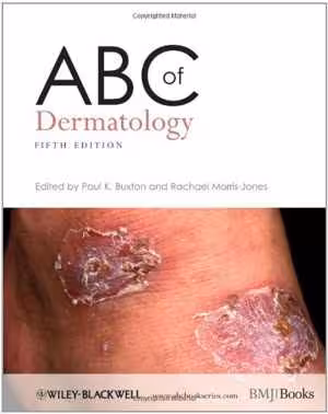 [PDF] دانلود کتاب Abc Of Dermatology, 5th ed, 2009
