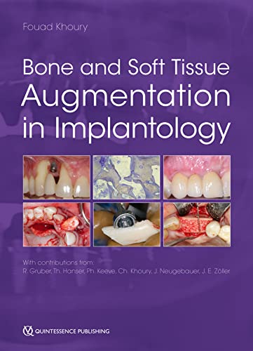 خرید و دانلود دانلود کتاب Bone and Soft Tissue Augmentation in Implantology