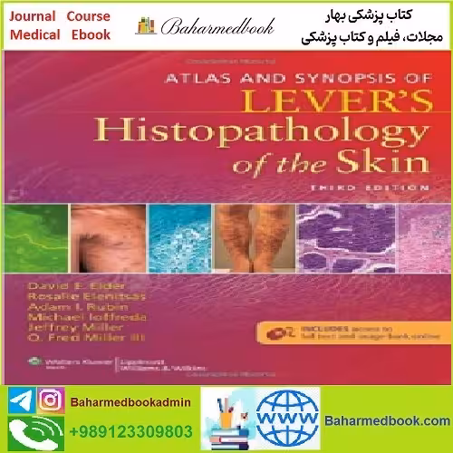 Atlas and Synopsis of Lever's Histopathology of the Skin TRUE