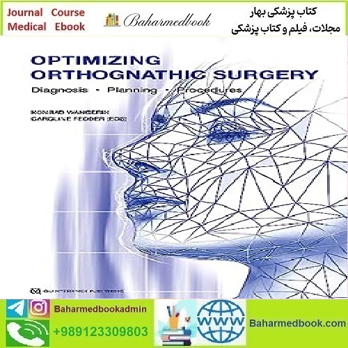 Optimizing Orthognathic Surgery Diagnosis Planning Procedures