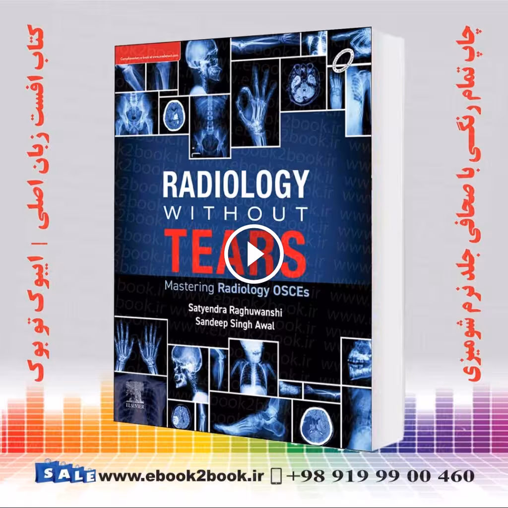 Radiology Without Tears: Mastering Radiology OSCEs