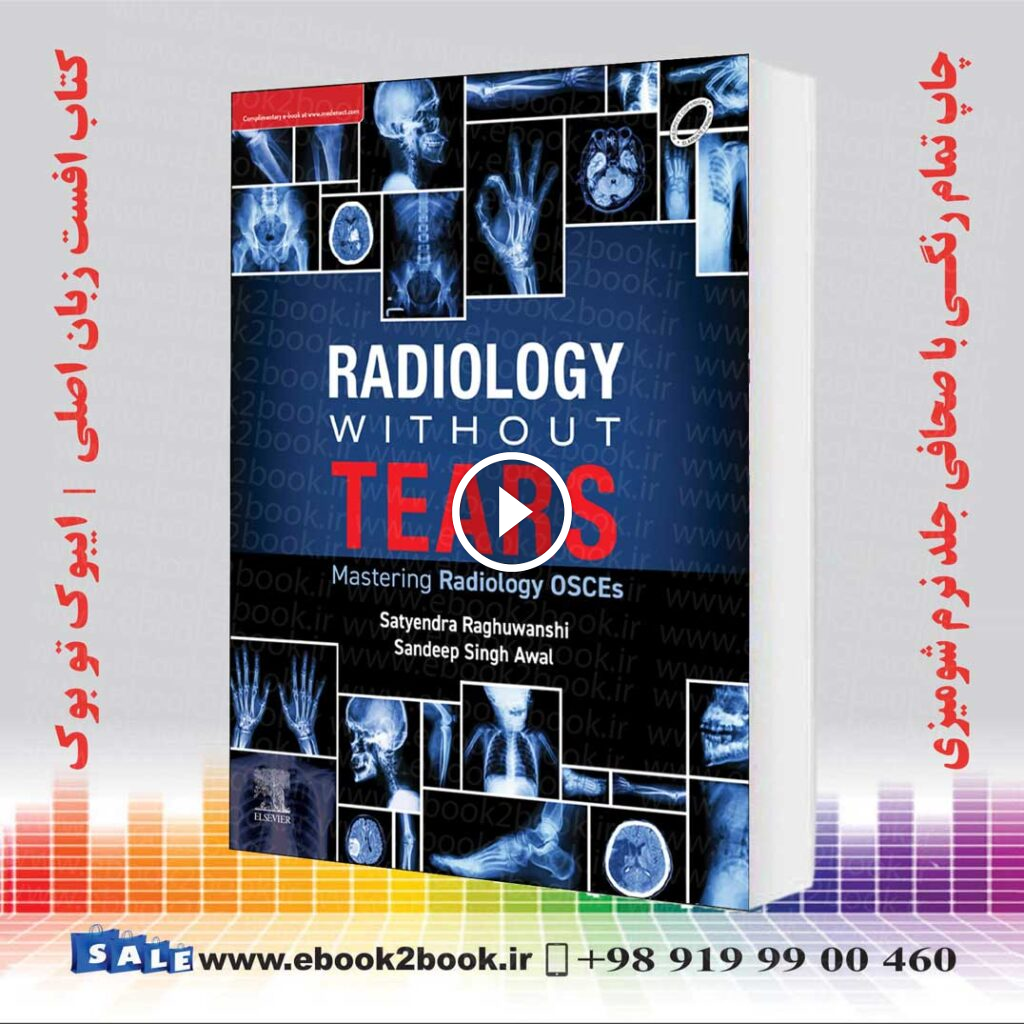 Radiology Without Tears: Mastering Radiology OSCEs