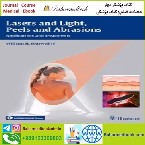 Lasers and Light Peels and Abrasions TRUE PDF price 1€ - کتاب پزشکی بهار
