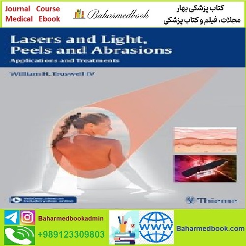 Lasers and Light Peels and Abrasions TRUE PDF price 1€ - کتاب پزشکی بهار