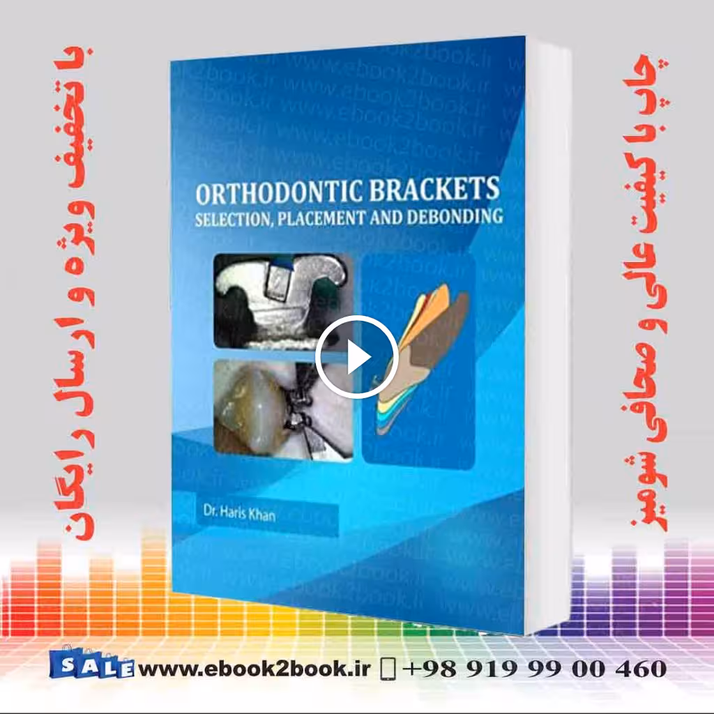 Orthodontic Brackets : Selection Placement and Debonding