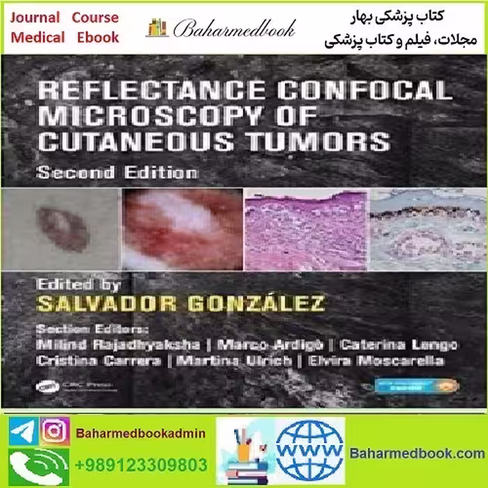 Reflectance Confocal Microscopy of Cutaneous Tumors TRUE