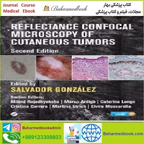 Reflectance Confocal Microscopy of Cutaneous Tumors TRUE