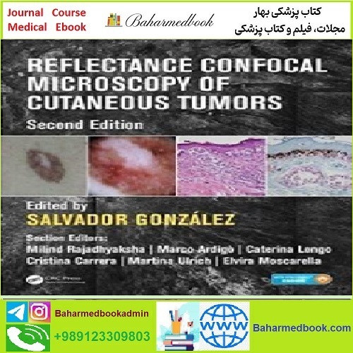 Reflectance Confocal Microscopy of Cutaneous Tumors TRUE