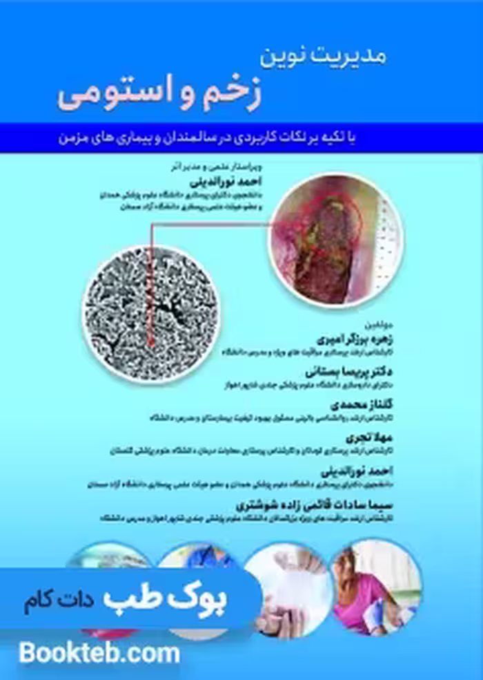 مدیریت نوین زخم و استومی