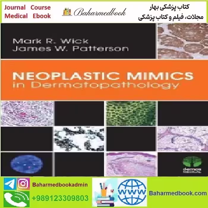 Neoplastic Mimics in Dermatopathology TRUE PDF price 1€ - کتاب پزشکی بهار