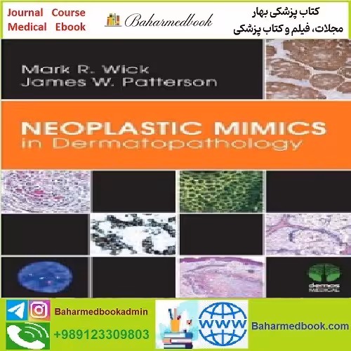 Neoplastic Mimics in Dermatopathology TRUE PDF price 1€ - کتاب پزشکی بهار