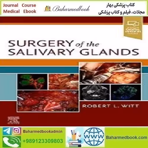 Surgery of the Salivary Glands 2021 TRUE PDF price 1€ - کتاب پزشکی بهار