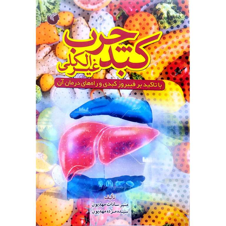 کبد چرب غیر الکلی