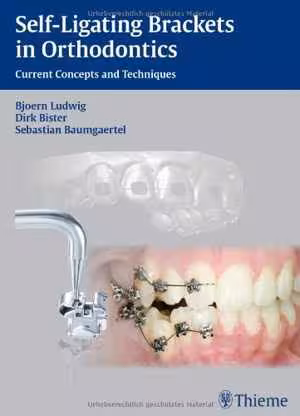 [PDF] دانلود کتاب Self-Ligating Brackets In Orthodontics - Current Concepts And Techniques, 2012