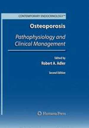 [PDF] دانلود کتاب Osteoporosis - Pathophysiology And Clinical Management, 2nd ed, 2010