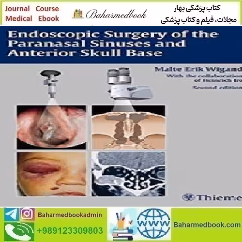 Endoscopic Surgery of the Paranasal Sinuses and Anterior Sku