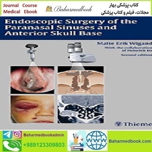Endoscopic Surgery of the Paranasal Sinuses and Anterior Sku