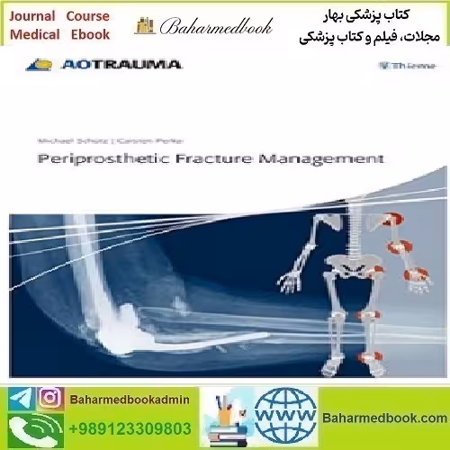 Periprosthetic Fracture Management 2014 TRUE PDF price 1€ - کتاب پزشکی بهار