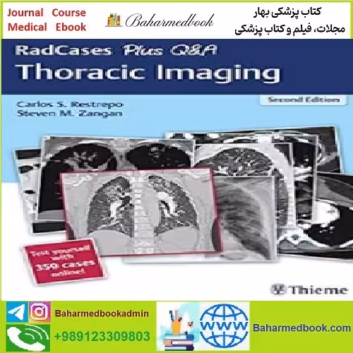 RadCases Plus Q&amp;A Thoracic Imaging TRUE PDF price 1€ - کتاب پزشکی بهار