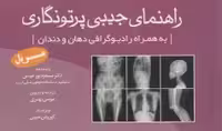 راهنمای جیبی پرتونگاری مریل