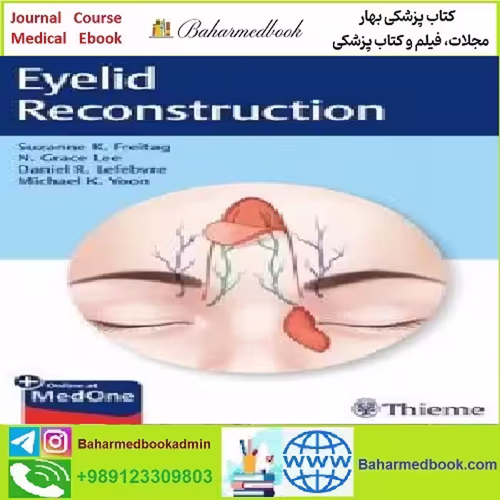 Eyelid Reconstruction TRUE PDF price 1€