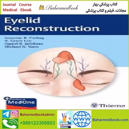 Eyelid Reconstruction TRUE PDF price 1€