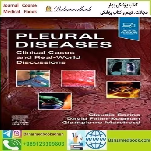 Pleural Diseases Clinical Cases and Real World Discussions Video
