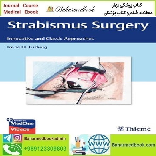 Strabismus Surgery Innovative and Classic Approaches Video