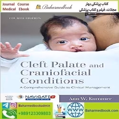 Cleft Palate and Craniofacial Conditions A