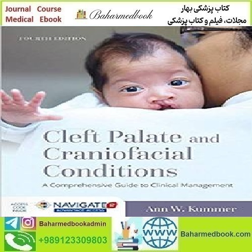Cleft Palate and Craniofacial Conditions A